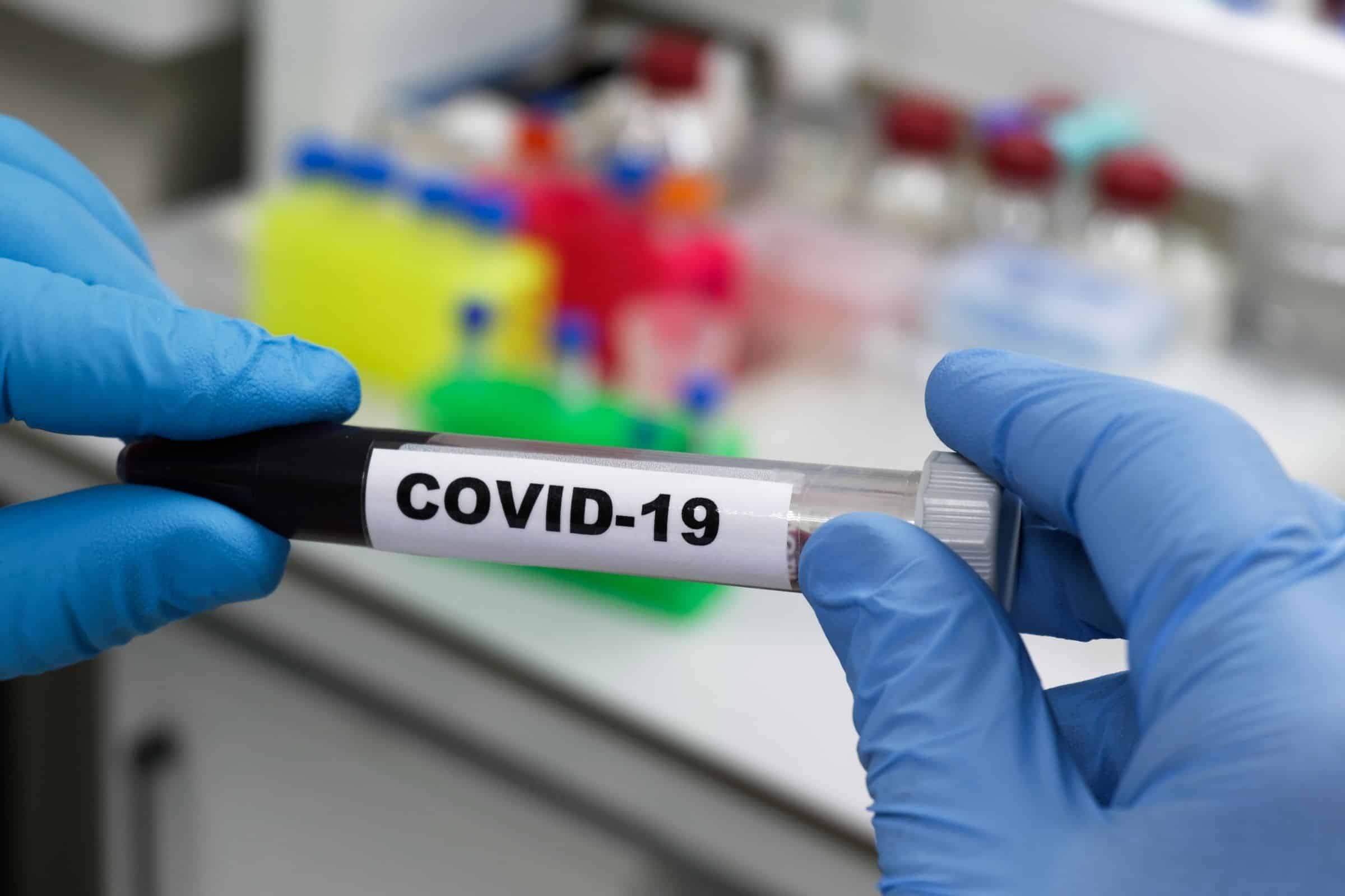 Ministerstwo Zdrowia 15 lipca poinformowało o 994 nowych przypadkach Covid-19 w Irlandii