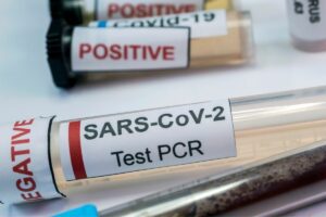 Prawie we wszystkich hrabstwach w Irlandii brak testów PCR na Covid-19